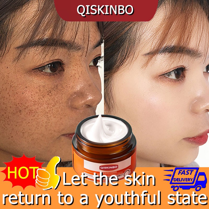 QISKINBO Nicotinamide Whitening Freckle Cream Dark Spot Remover ...