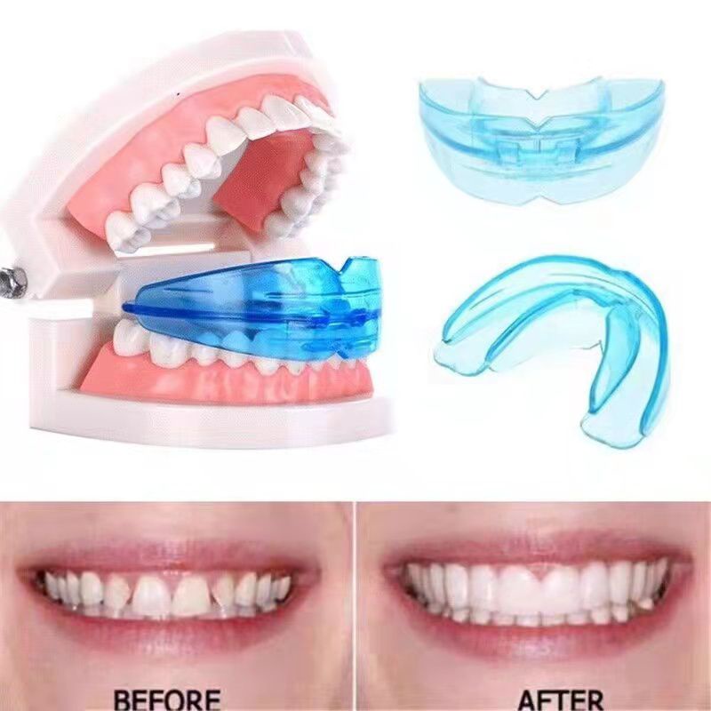 Teeth Alignment Retainer Dental Orthodontics Shopee Philippines