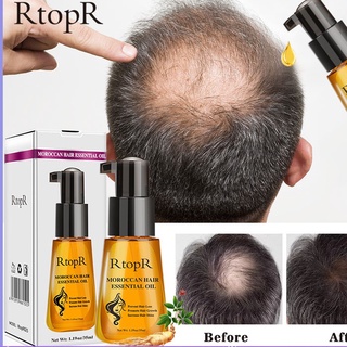 rosemary oil for hair growth RtopR Moroccan Prevent Hair Loss Product ...