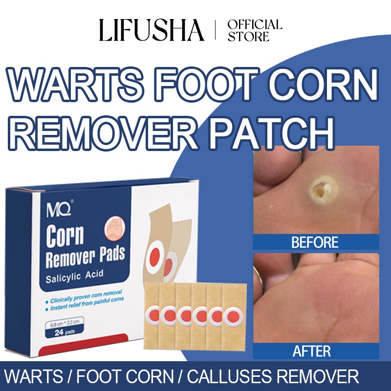 LIFUSHA 24PCS Foot Corns Remover Patch Warts Remover Pad Callus Removal