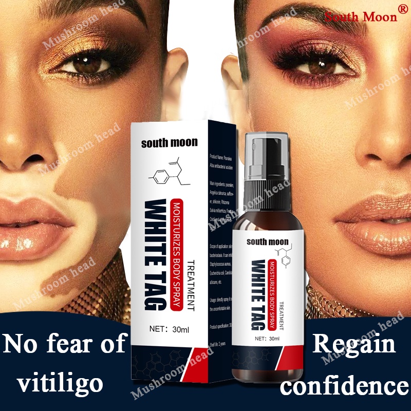 South Moon vitiligo treatment cream mustard oil for vitiligo remover