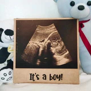 3D Ultrasound Crystal Ball - Personalized Digital Photo & Video Player With Heartbeat