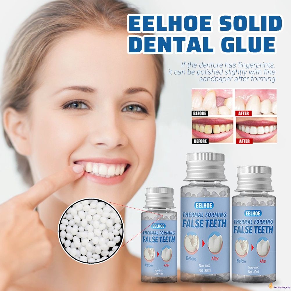 READY Temporary Tooth Repair Waterproof Glue Dentist Tooth Filling Hole Filler Fix Kit Caries