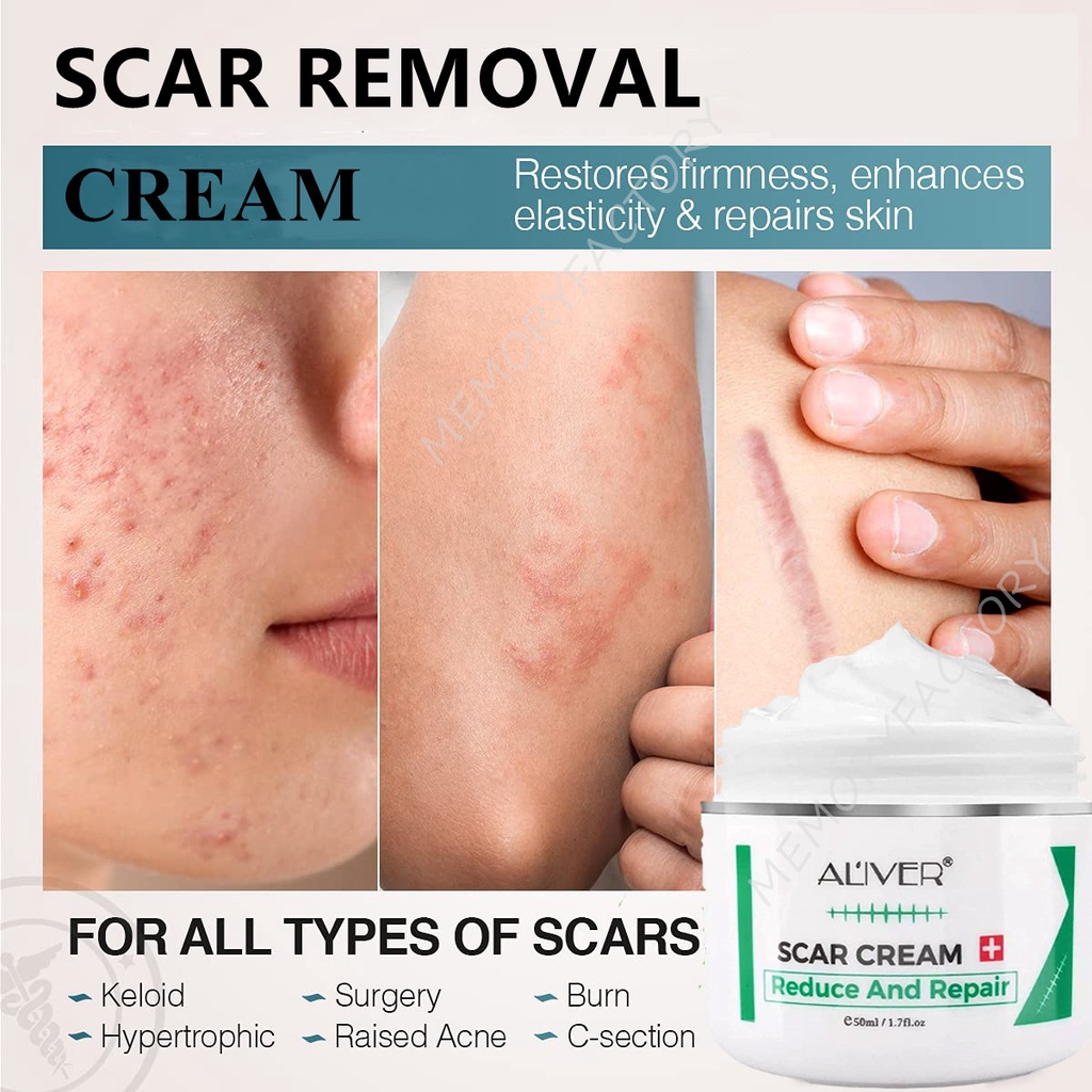 ALIVER Scar Repair Cream Remove Acne Scar Stretch Mark Scald Scar