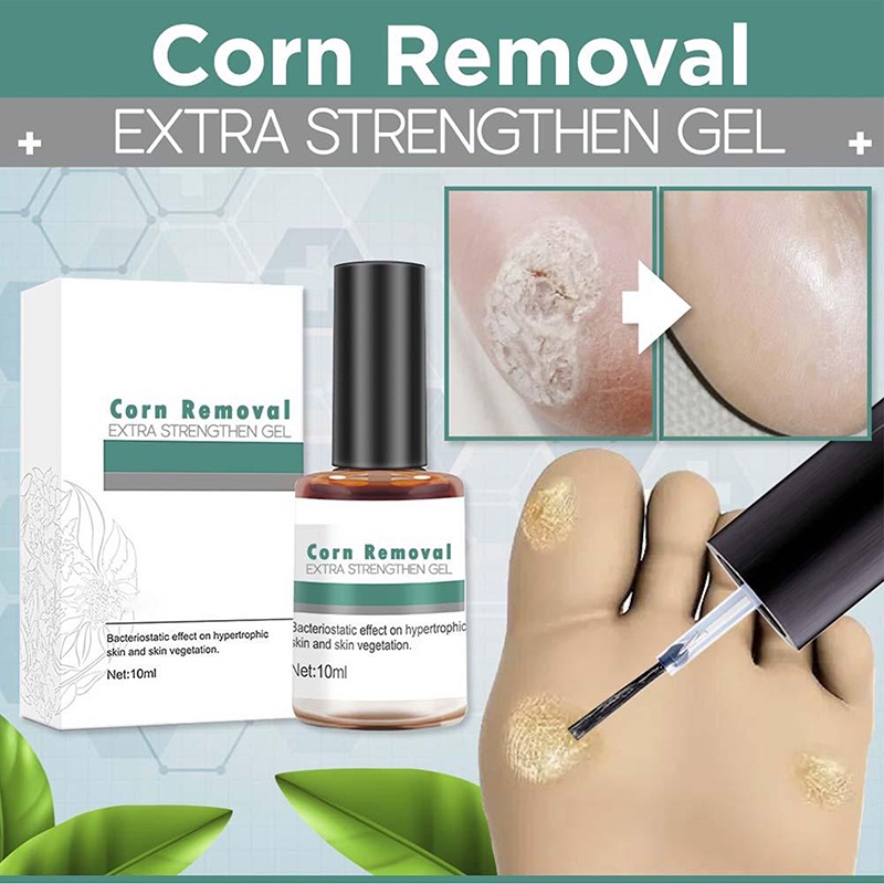 ⊙№Corn Removal Extra Strengthen Gel Warts Remover Skin Tag Remove Corns