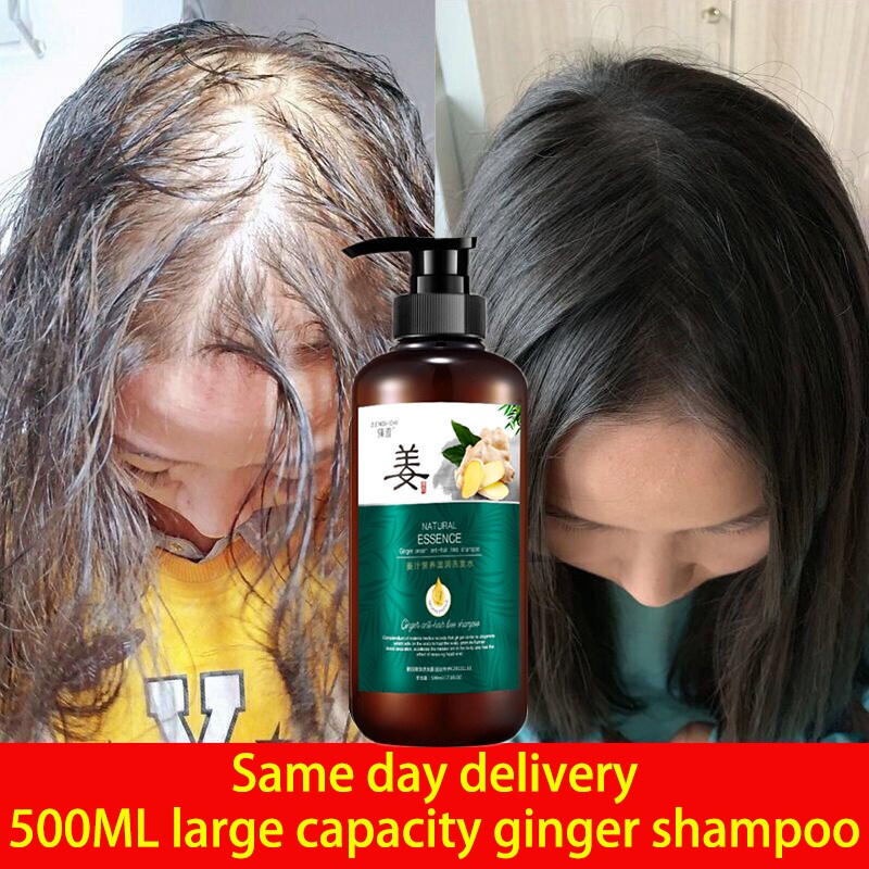 horse shampoo hair growth ♣Ginger shampoo Anti dandruff shampoo anti