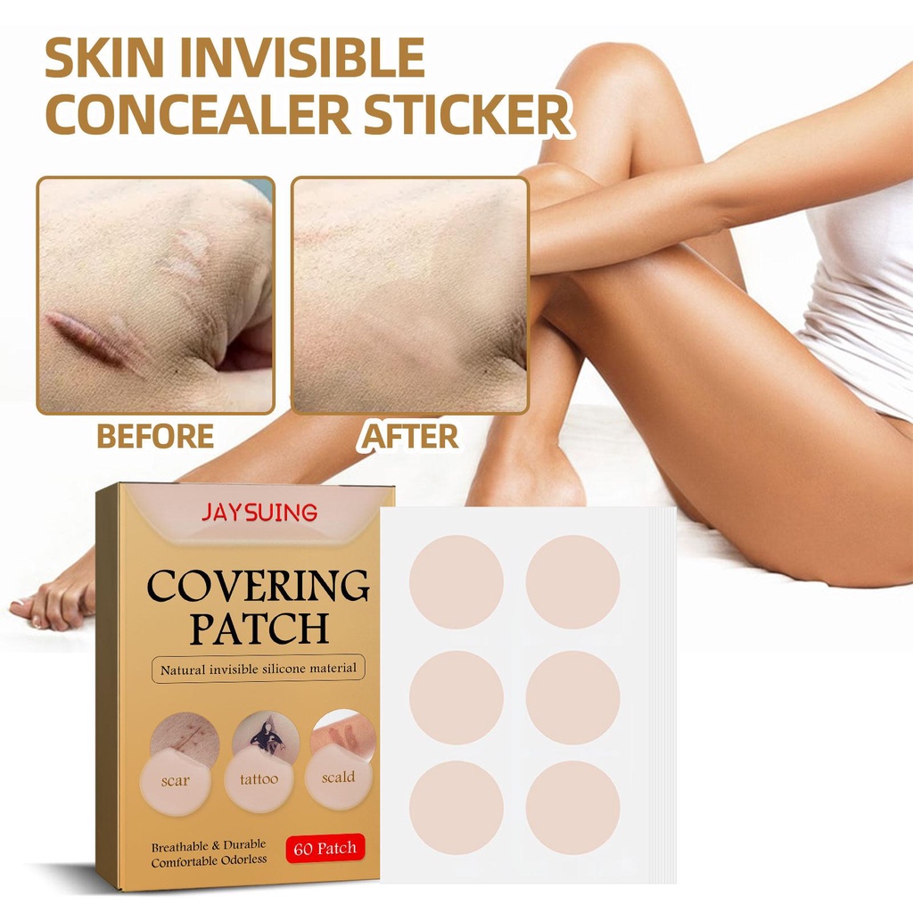 Seebee 60pcs Skin Invisible Concealer Sticker Cover Mole Sticker Cover ...