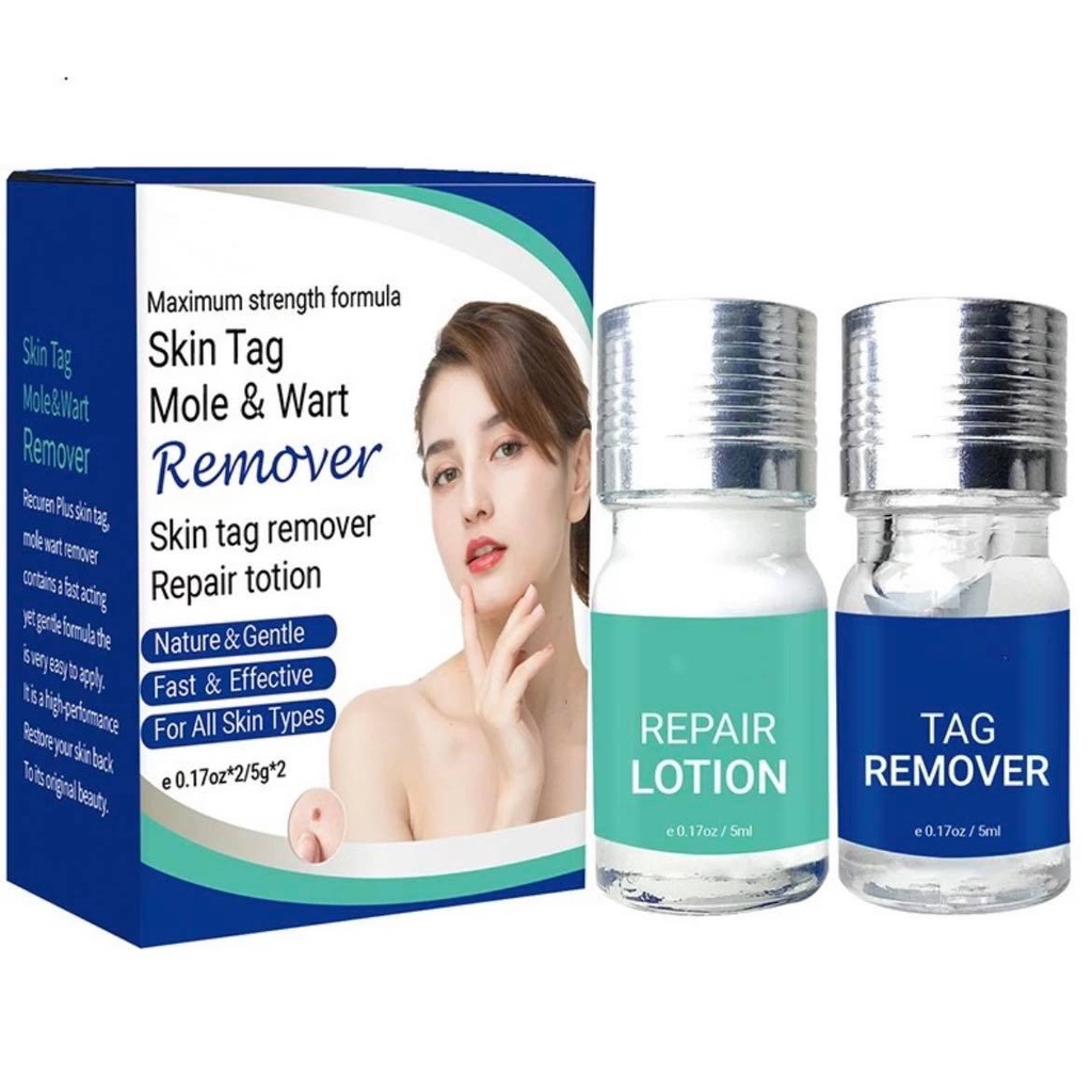 100% EFFECTIVE SKIN TAG AND WARTS REMOVER AND REPAIR LOTION | Shopee ...