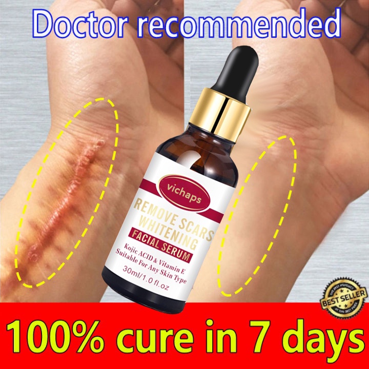 scar removal serum scar remover for legs Acne Treatment Anti Acne skin care old Scar Remover