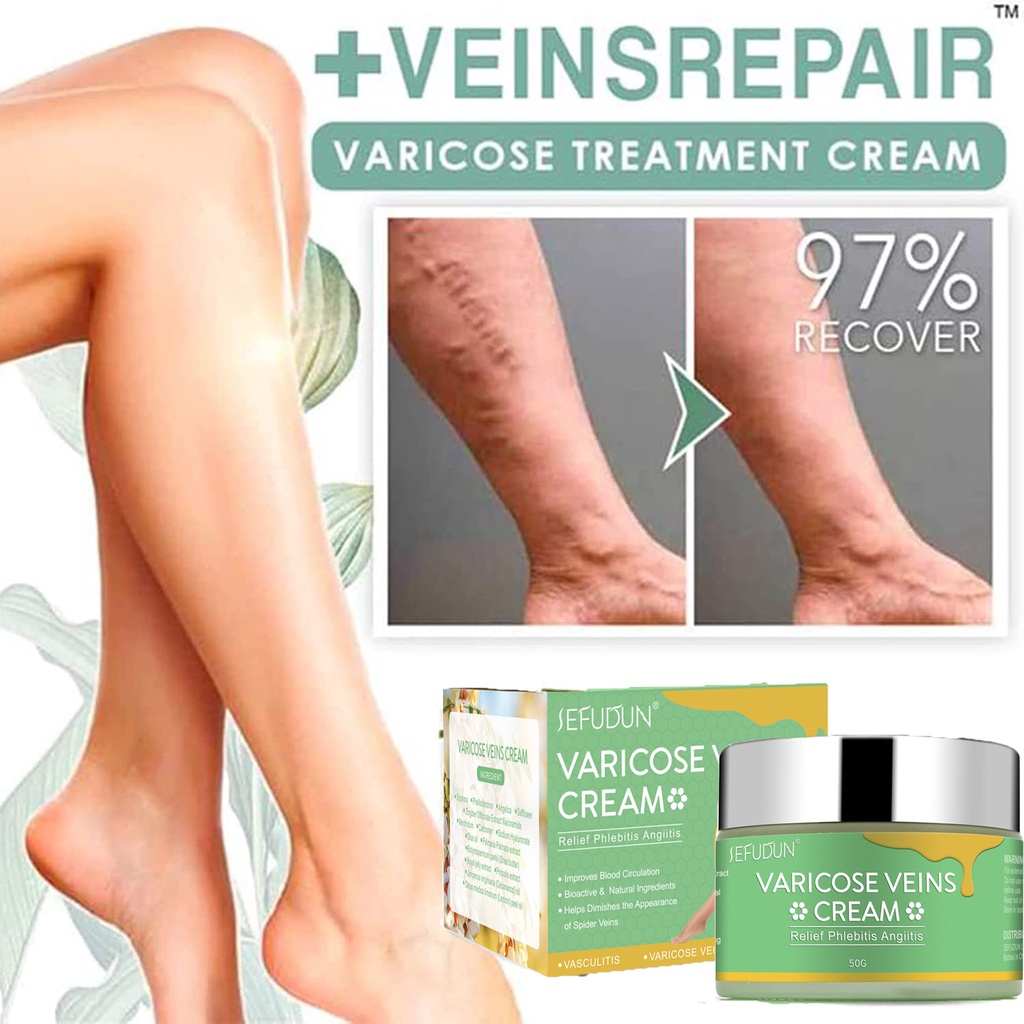 Sefudun Varicose Vein Treatment Cream Effective Cure Vasculitis Vein Pain Varicosity Spider Leg