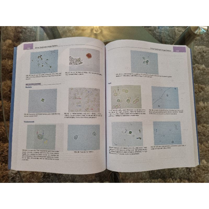 Fundamentals of Urine and Body Fluid Analysis 4th Edition- Nancy ...