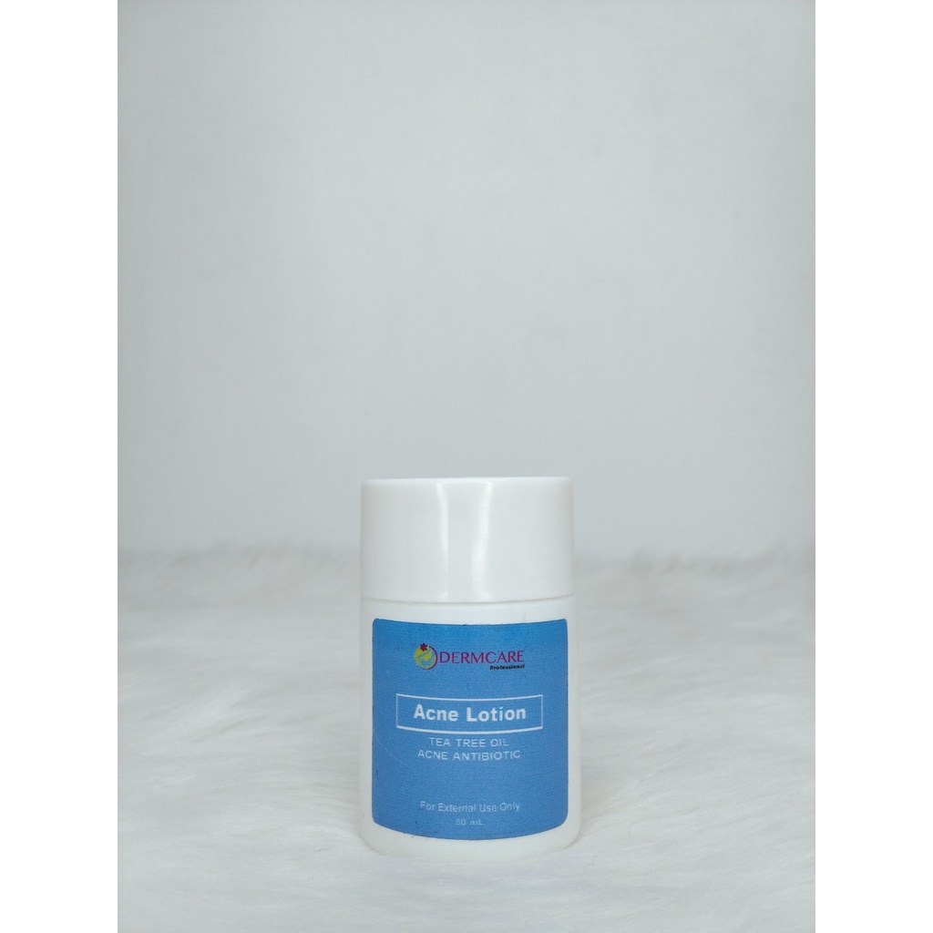 Acne Lotion Treatment Shopee Philippines