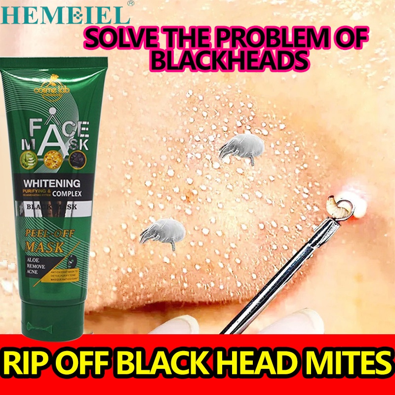 HEMEIEL Black Heads Remover Strip/Blackheads And Whiteheads Remover