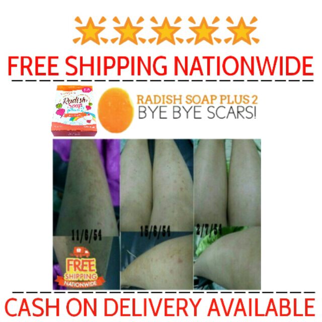 FREE SF COD Radish Soap SKIN WHITENING SCAR REMOVER Shopee