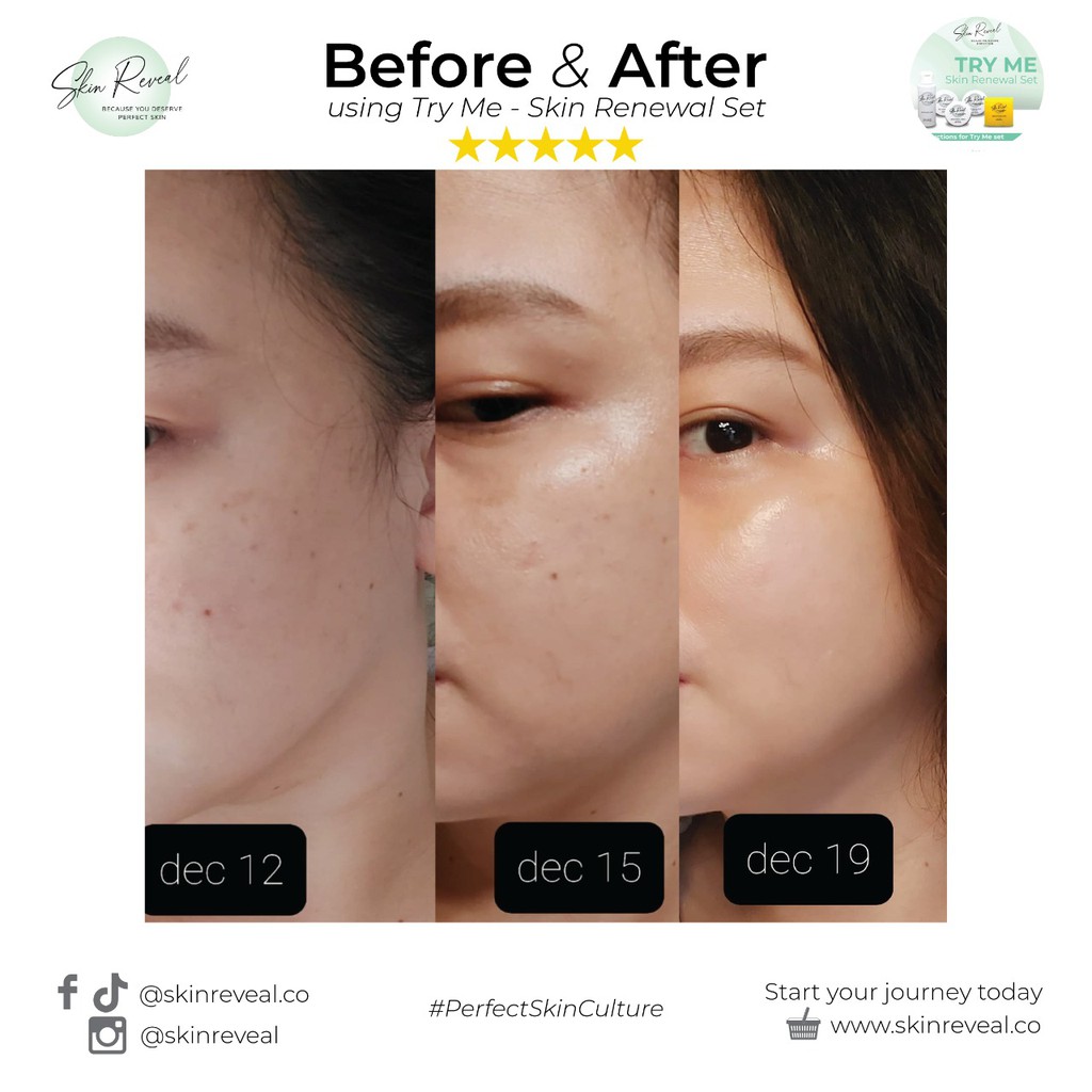 Skin renewal deals