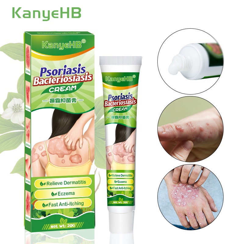 eczema cream psoriasis cream herbal treatment itchy skin antifungal