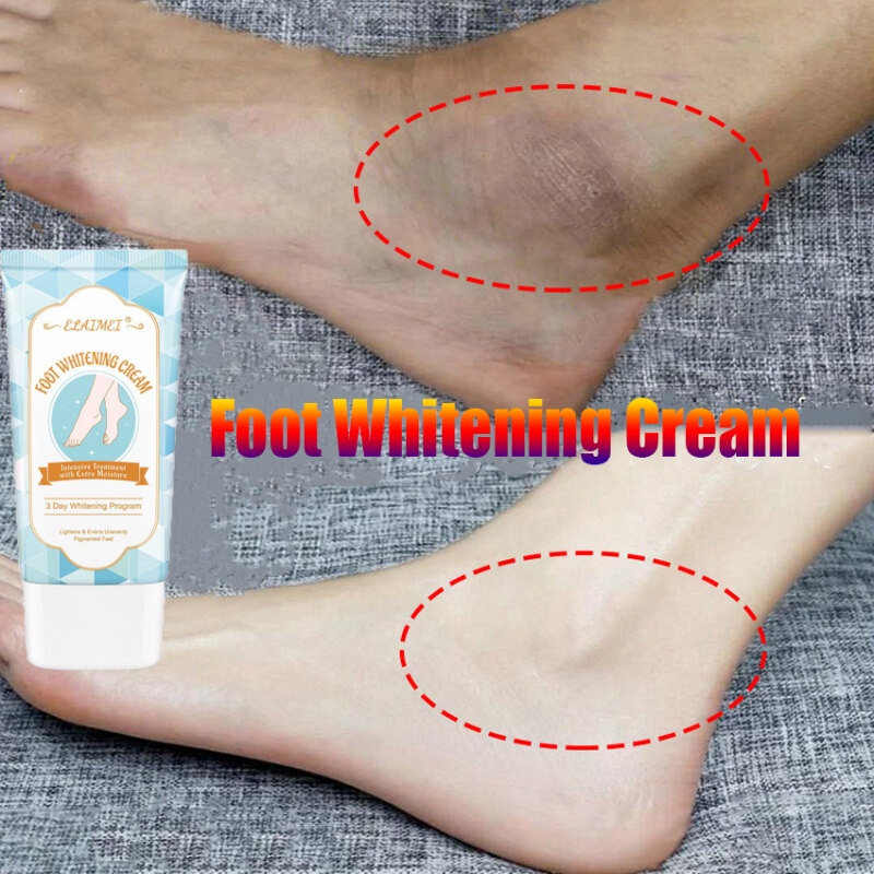 60ml ELAIMEI Foot Whitening Cream Anti Cracking Moisturizing Treatment