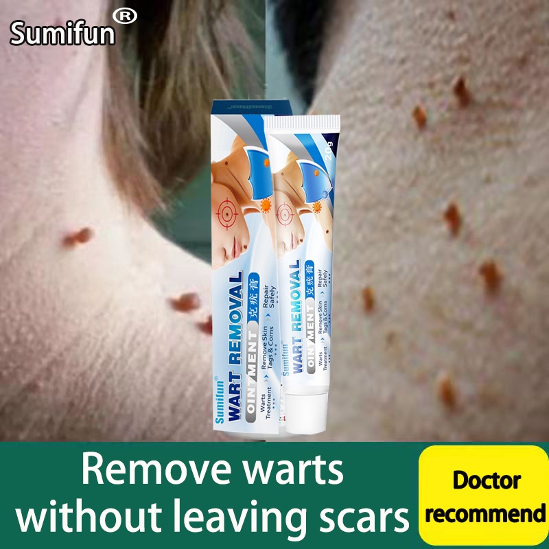 Warts Remover Original Cream Wart Removal Ointment Wart Treatment Skin Tags Mole Remover Cream 2969