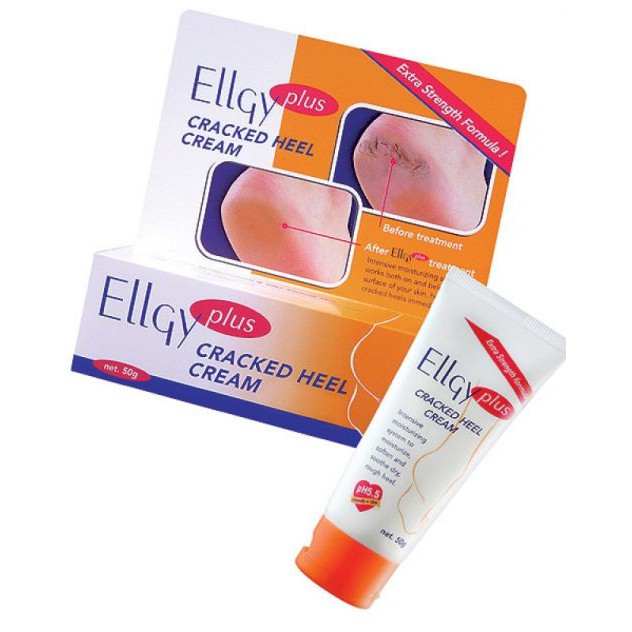 Cracked Heels Cream 5g/10g in Tube Packaging for Foot Care Shopee