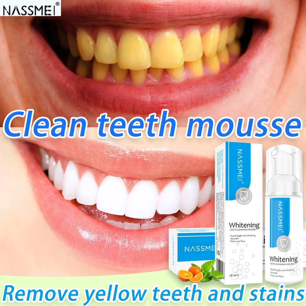 NASSMEI Clean teeth mousse Whitening Mousse Whitening toothpaste Teeth ...