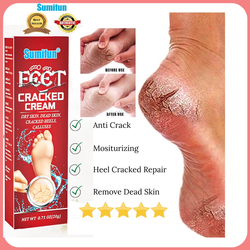 Dry Skin Best Products For Cracked Feet Quick Fix】hand Foot Cream