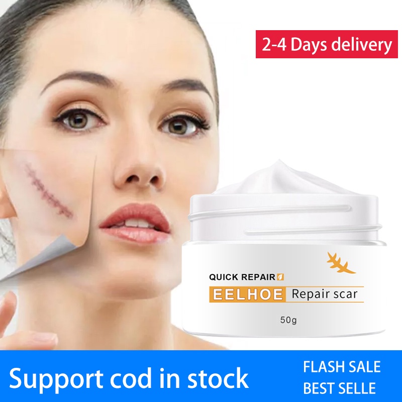 ♂ Effective Best Scar Remover Cream Stretch Mark Remover Anti Acne