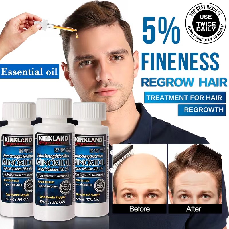 Kirkland Signature Hair growth Treatment Extra Strength for Men 5% ...