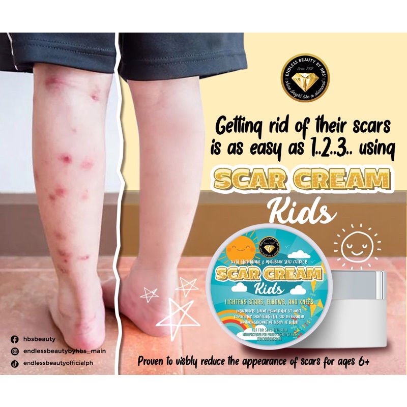 SCAR CREAM Fader for Kids 6yrs UP Lightens Scars Elbows Knees