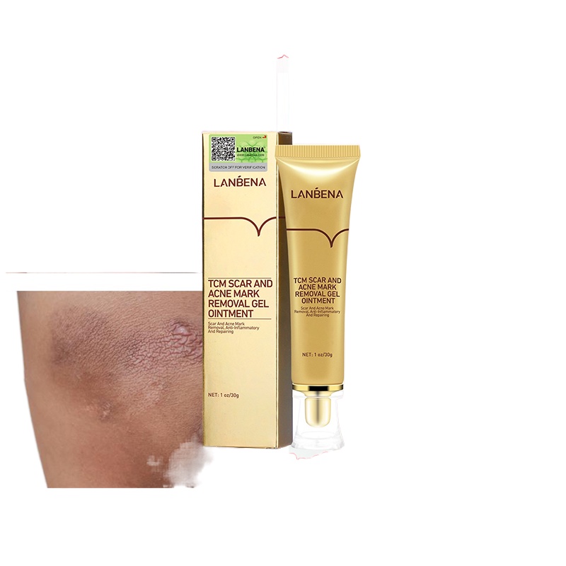 LANBENA Original TCM Acne Scar Removal Cream Blackhead Pimple Stretch