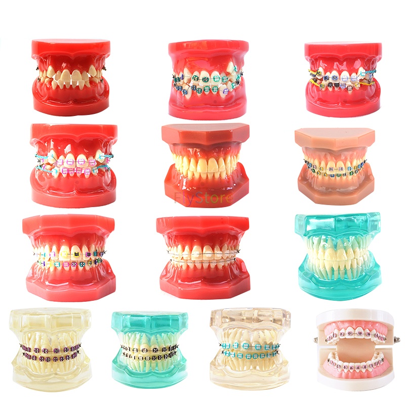 Dental learning teach model dental orthodontics orthodontic model oral