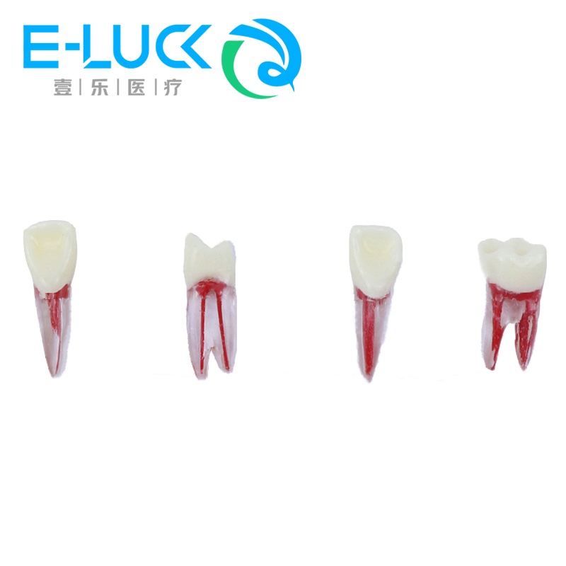 1pcs Dental Endodontic Tooth Model With Colored Root Canal And Pulp ...