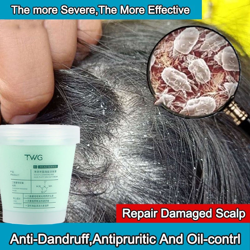 Anti Dandruff Anti Mites Shampoo Clean Scalp Itching Improving Hair