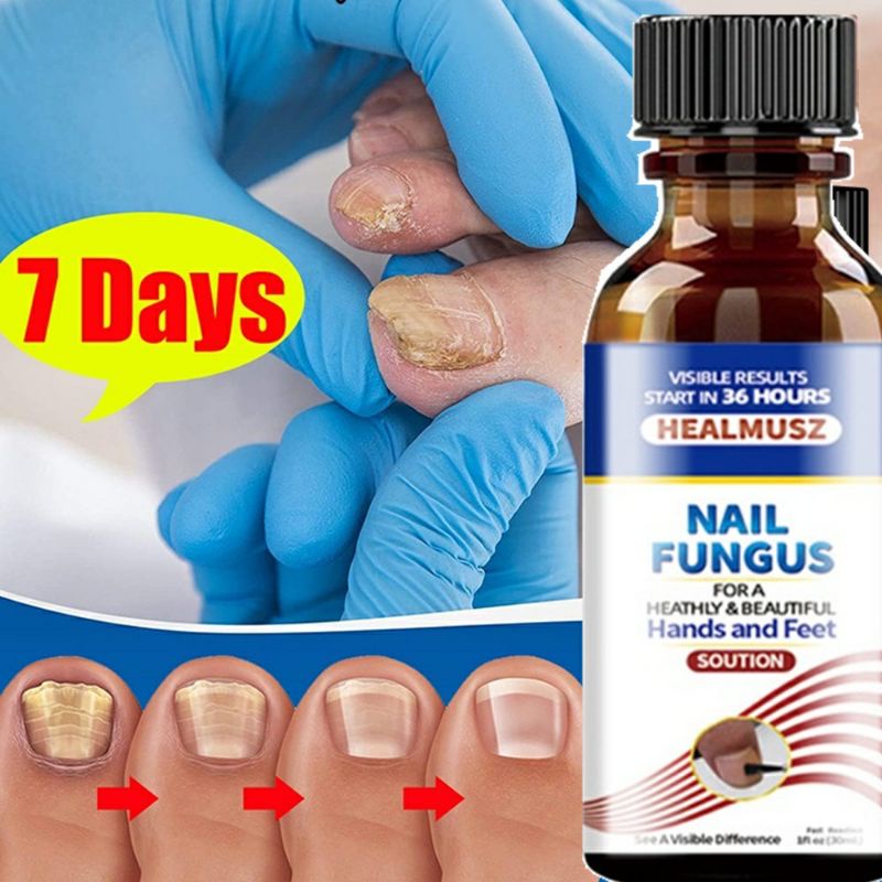 thumbnail image 2 of HEALMUSZ Anti Fungal Nail Treatment – Jumbo Pack, All-Natural, Alcohol-Free 2 of 3