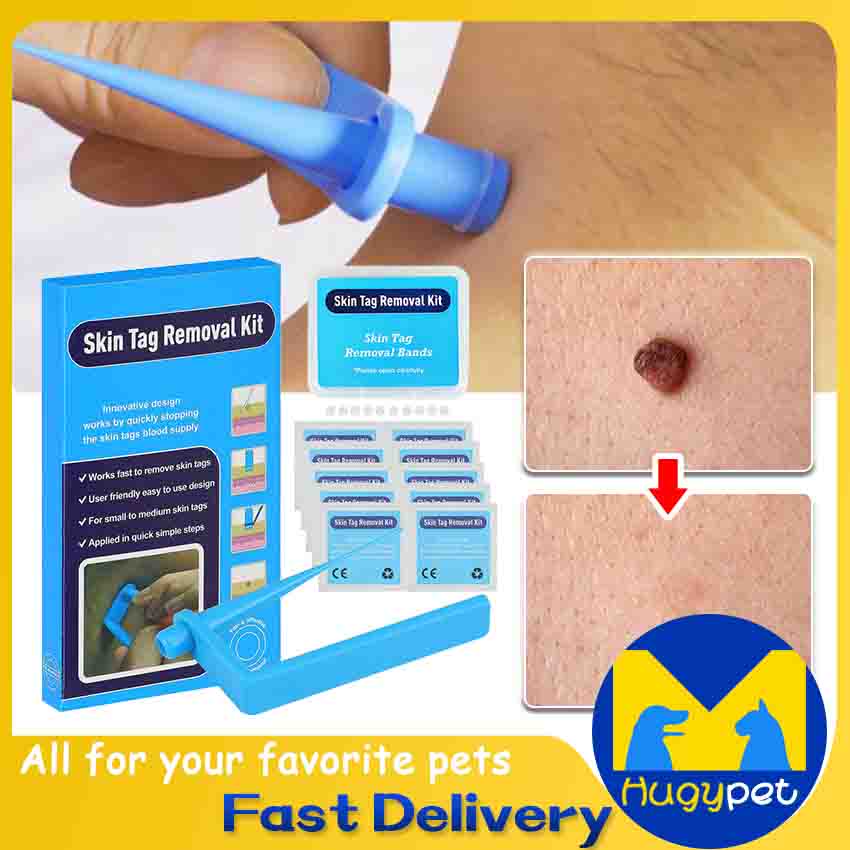 Skin Tag Removal Kit Skin Mole Wart Remover Micro Band Removal Kit Skin Tag Treatment Tools Set