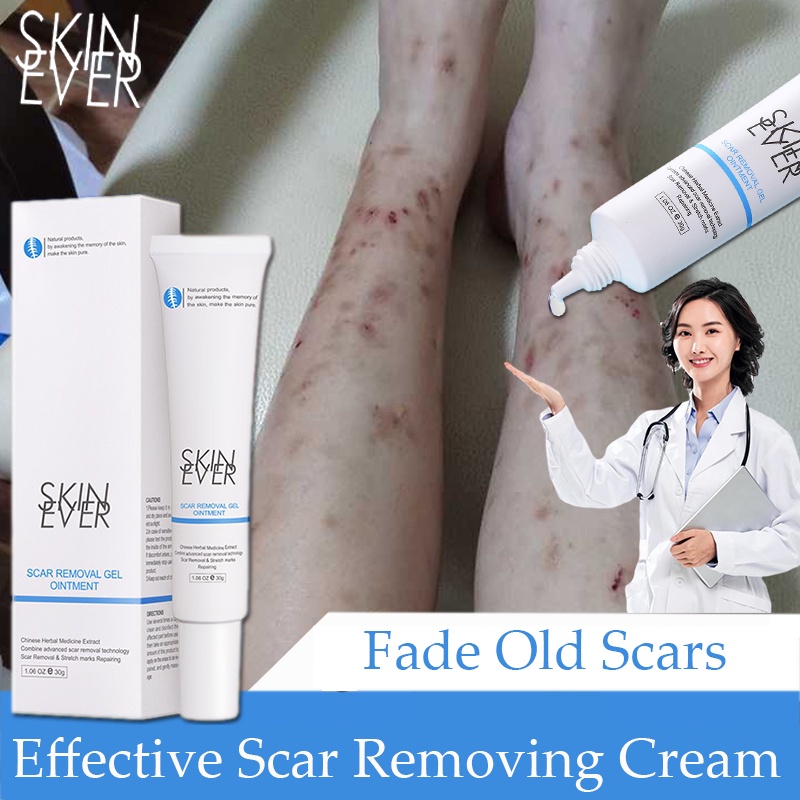 Scar removal clearance cream