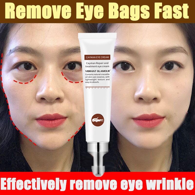 Eyebag Remover Cream Retinol Eye Cream for dark circle & eyebags