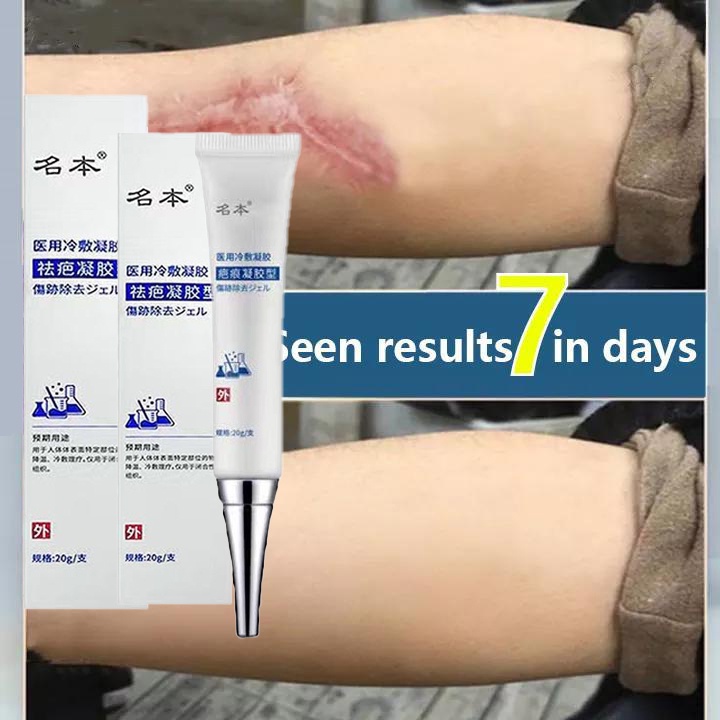 Scar Remover Cream 20g Skin Repair Cream Acne Scar Remove Spots Acne