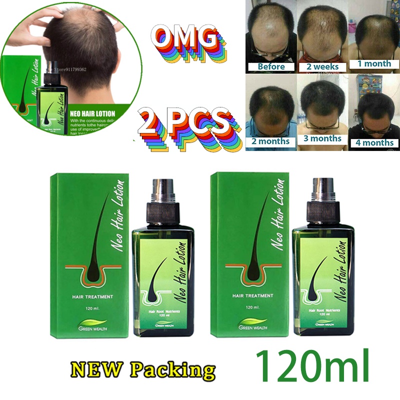 Rosemary Oil For Hair Growth Thailand Original 120ml Neo Hair Growth Oil Hair Lotion Thailand 3451