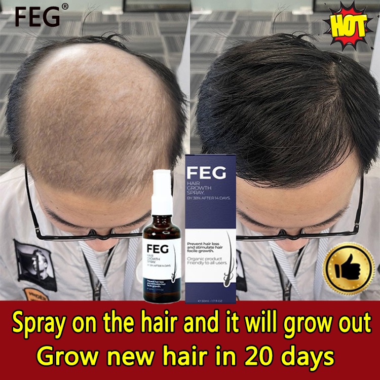 Feg Hair Growth Spray 50ml Rapid Hair Growth Spray Once In The Morning And Evening To Solve The 6964