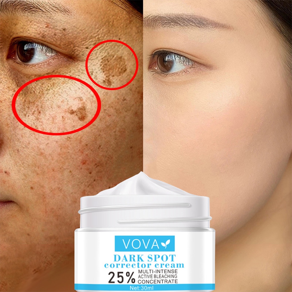VOVA Dark Spot Removal Whitening Skin Cream Remove Melasma Acne Spot