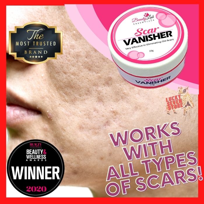 TOTALLY LEGIT BESTSELLING SUPER EFFECTIVE SCAR REMOVER CREAM SCAR