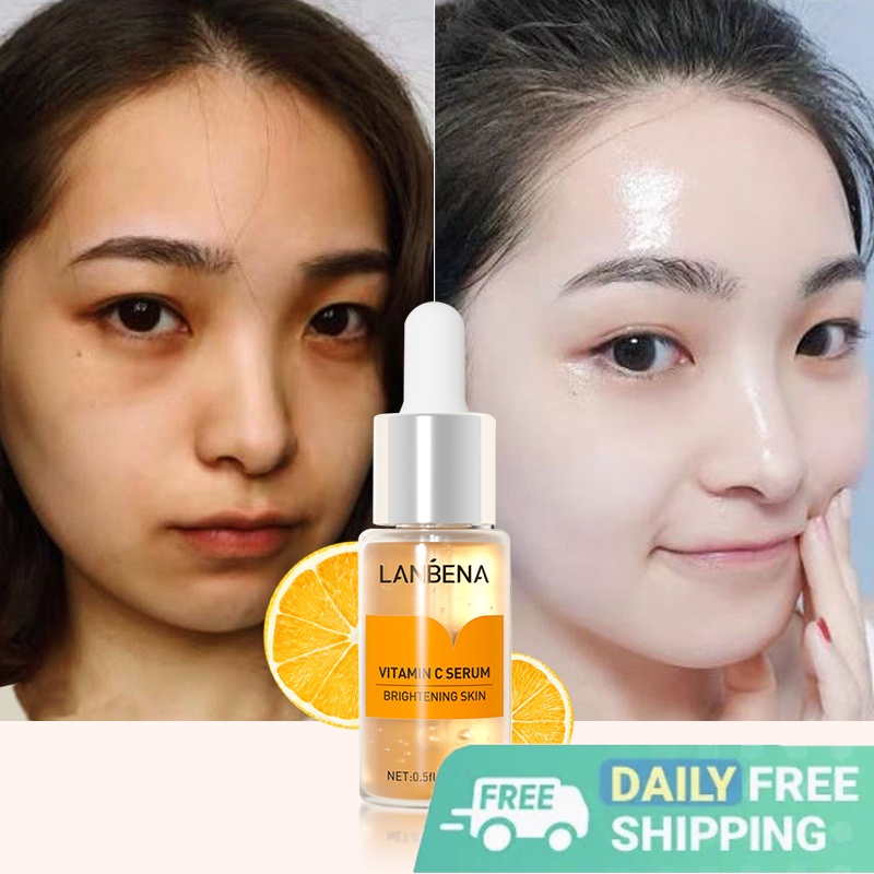 Garnier Bright Complete Anti Acne Super Glow Day Trio Cleanser with