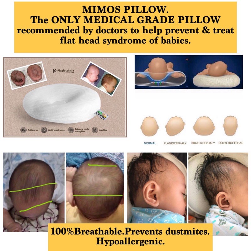 Mimos Pillow is the only medical grade baby pillow to prevent