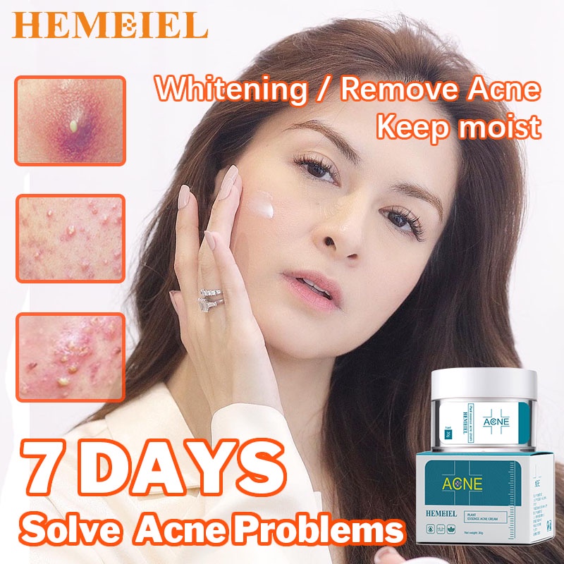 HEMEIEL Pimple Marks Acne Remover | Adapalene Clindamycin | Back Acne