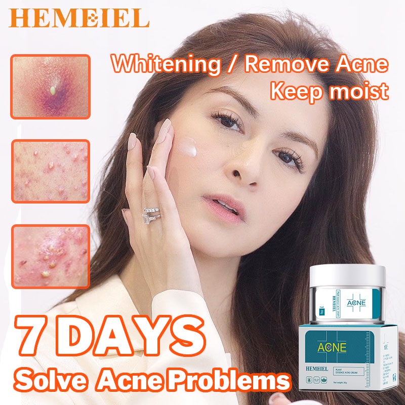 hemeiel-pimple-marks-acne-remover-adapalene-clindamycin-back-acne