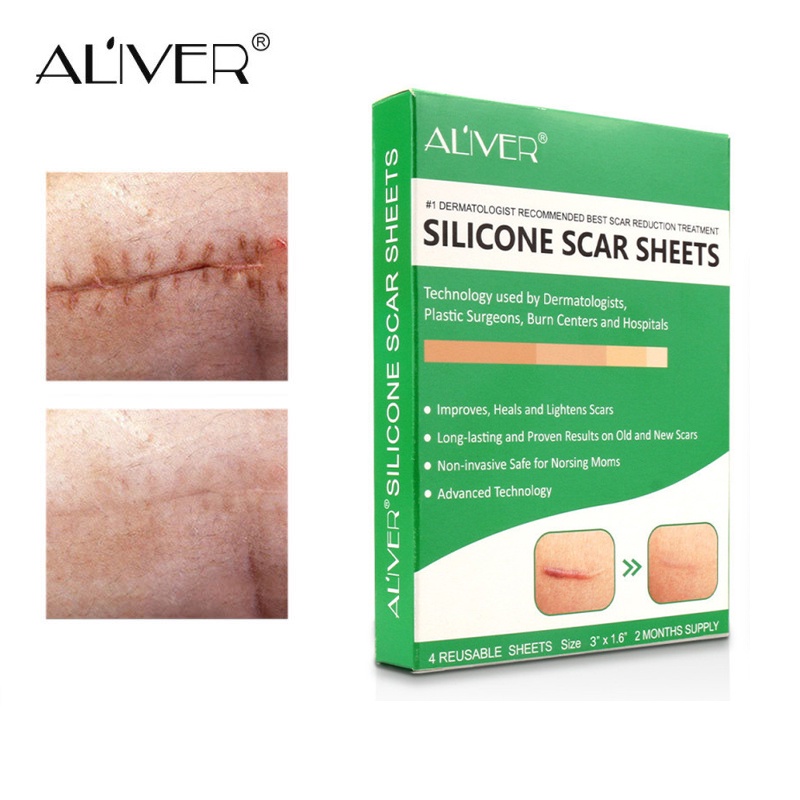 Reusable Silicone Scar Sheets Removal Patch Acne Gel Scar Remove Trauma ...