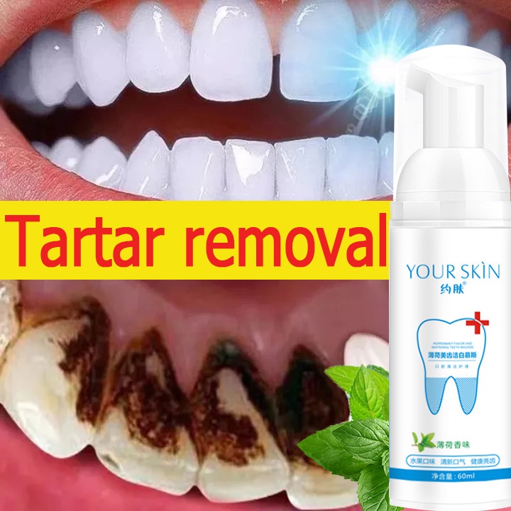 Teeth Whitening Mousse Toothpaste Mouthwash Remove Tartar oral health