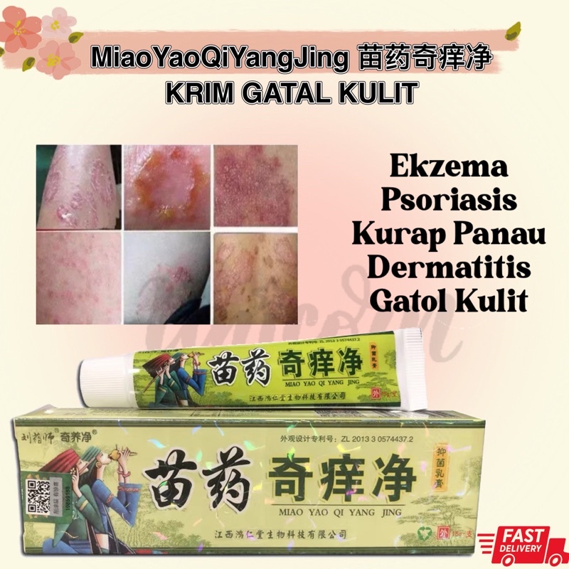 Psoriasis Eczema Cream Antifungal Antibacterial Itchy Cream Ubat Gatal ...