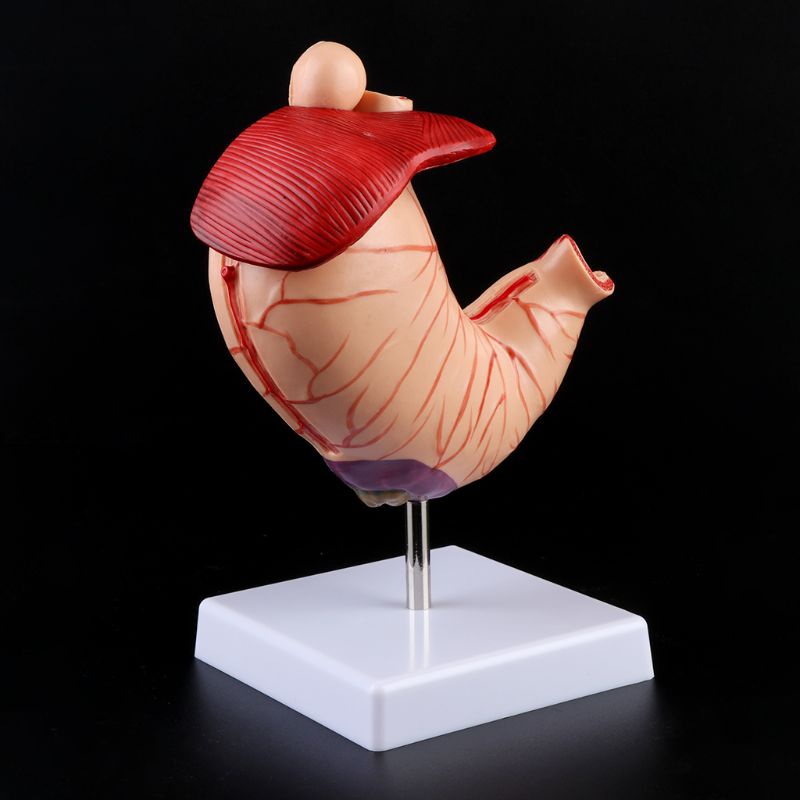 RAN Human Anatomical Anatomy Stomach Medical Model Gastric Pathology ...