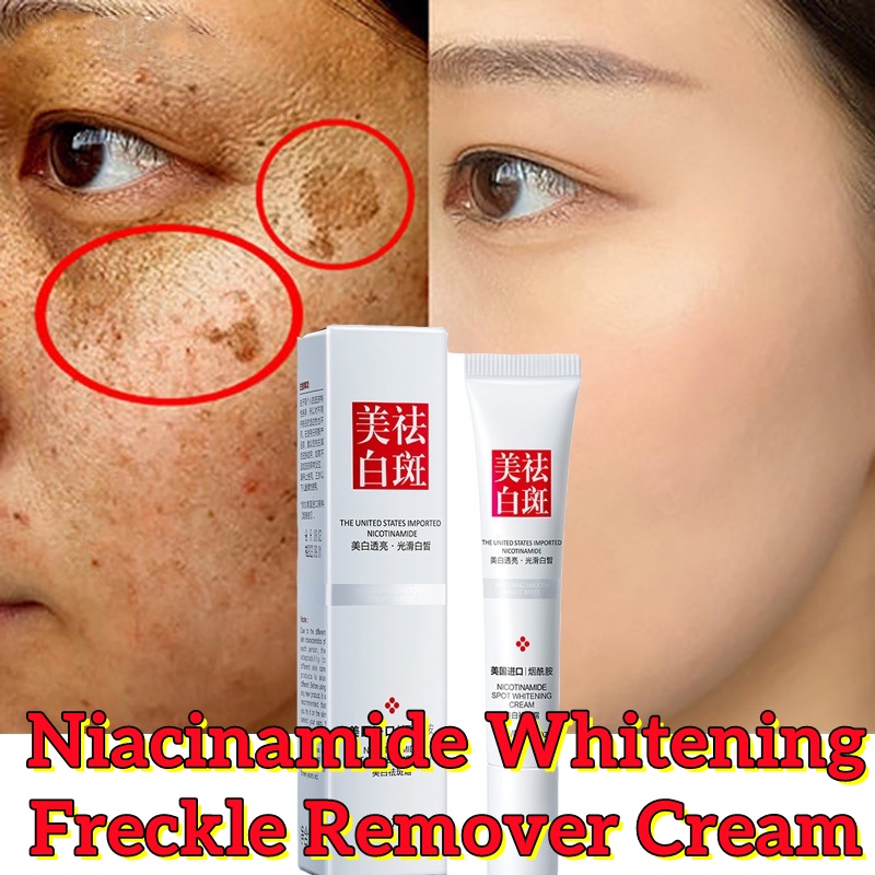 G Facial Dark Spot Remover Cream Freckle Whitening Cream Nicotinamide Smooth Brightening Skin